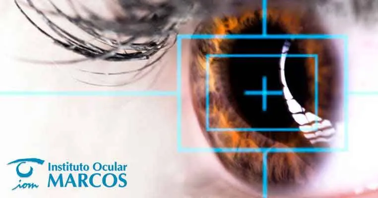 Instituto Ocular Marcos, un referente en operación de miopía en Málaga
